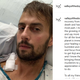 Image for article titled Ryan Fischer, Lady Gaga's Dogwalker, Is Doing Better and Wants to Thank His Dog Guardian Angel
